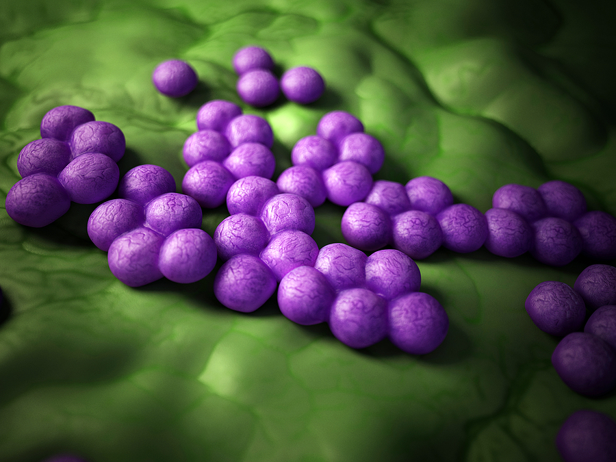 Microscopic illustration of MRSA (Staphylococcus aureus) bacteria